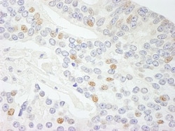 NCOA5 Antibody, Novus Biologicals 0.1mL; Unlabeled:Antibodies, Polyclonal